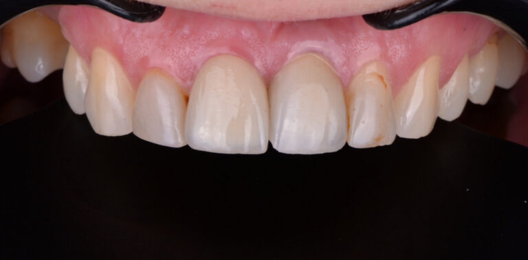 Метаморфоза 61 - przed