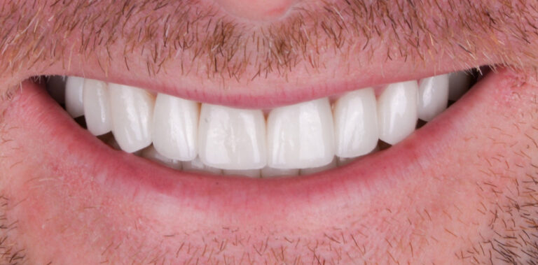 Метаморфоза 77 - po