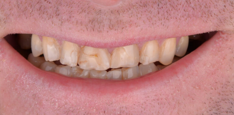 Метаморфоза 77 - przed