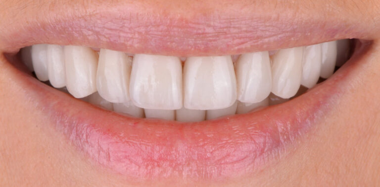 Метаморфоза 36 - po