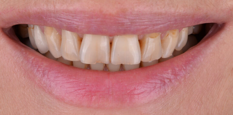 Метаморфоза 36 - przed