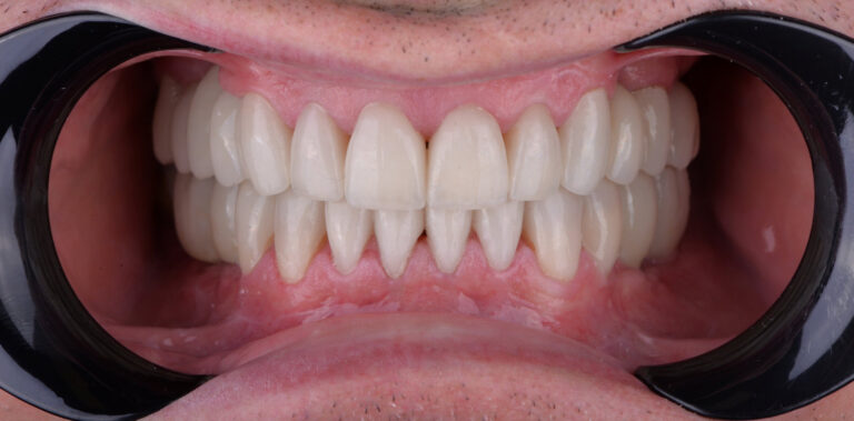 Метаморфоза 35 - po