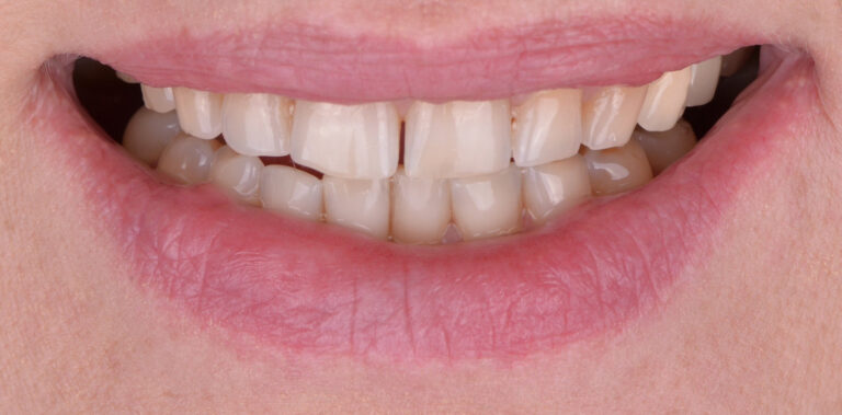 Метаморфоза 5 - przed