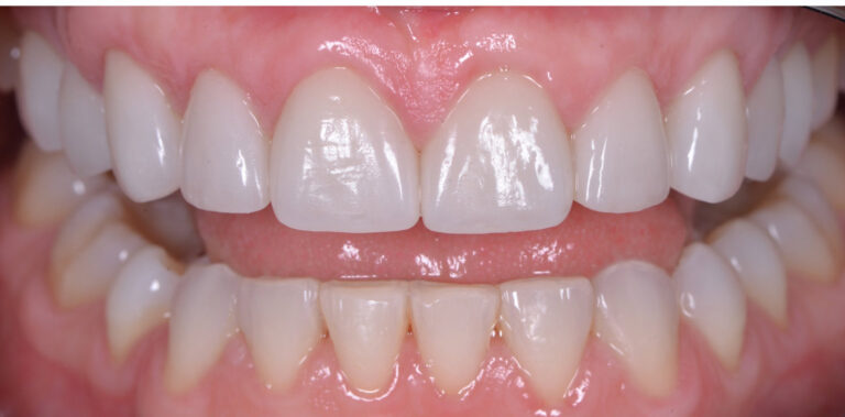 Метаморфоза 18 - po