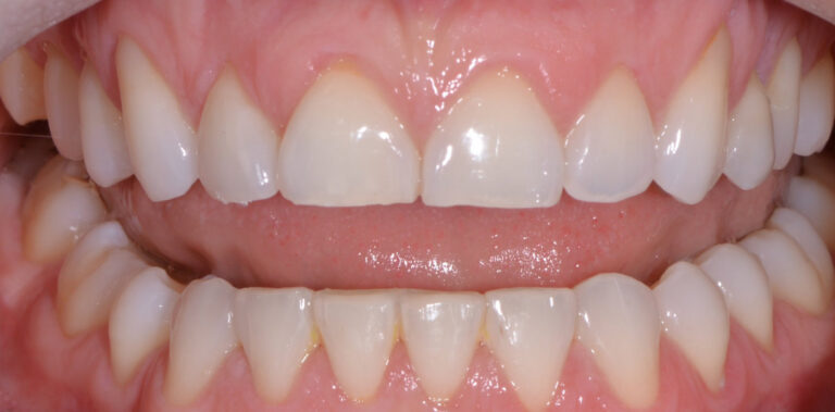 Метаморфоза 18 - przed