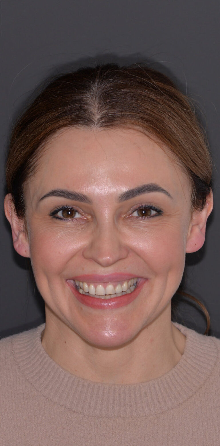 Метаморфоза 95 - przed