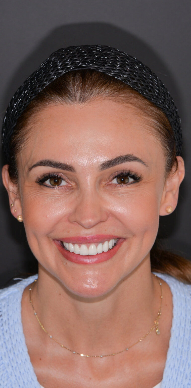 Метаморфоза 95 - po