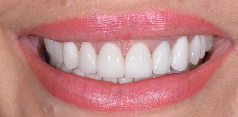 Метаморфоза 25 - po